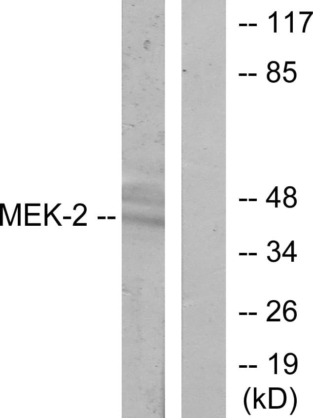 MAP2K2 / MKK2 / MEK2 Antibody (aa261-310)