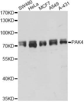 PAK4 Antibody