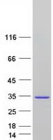 Human SPATA24 Protein (Recombinant Myc-DDK (Flag))
