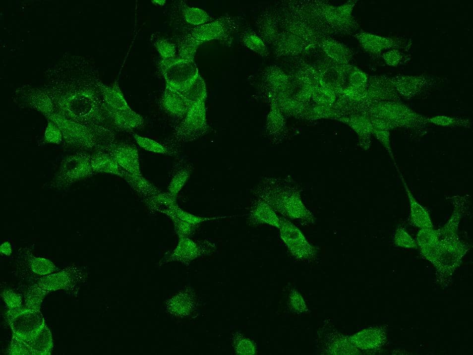 PPP1R1B / DARPP-32 Antibody