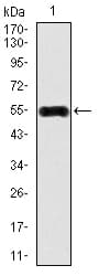 CAMK4 / CaMK IV Antibody (clone 8C5B8)