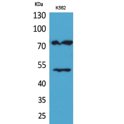 HDC / Histidine Decarboxylase Antibody (191-240 aa, Internal)