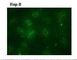 Monoclonal Mouse anti-Human TOP2A / Topoisomerase II Alpha Antibody (clone 1C5, IHC, WB)