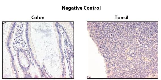 TNFRSF10A / DR4 Antibody (clone TR1.02)