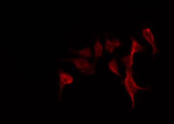 ADGRF5 / GPR116 Antibody