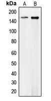 Polyclonal Rabbit anti-Human COL4A1 / Collagen IV Alpha1 Antibody (N-Terminus, IHC, WB)