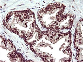 Monoclonal Mouse anti-Human UPRT Antibody (clone OTI1C9, IHC, WB)