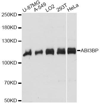 TARSH / ABI3BP Antibody