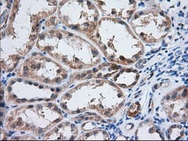 IGF2BP2 Antibody (clone OTI3C8)