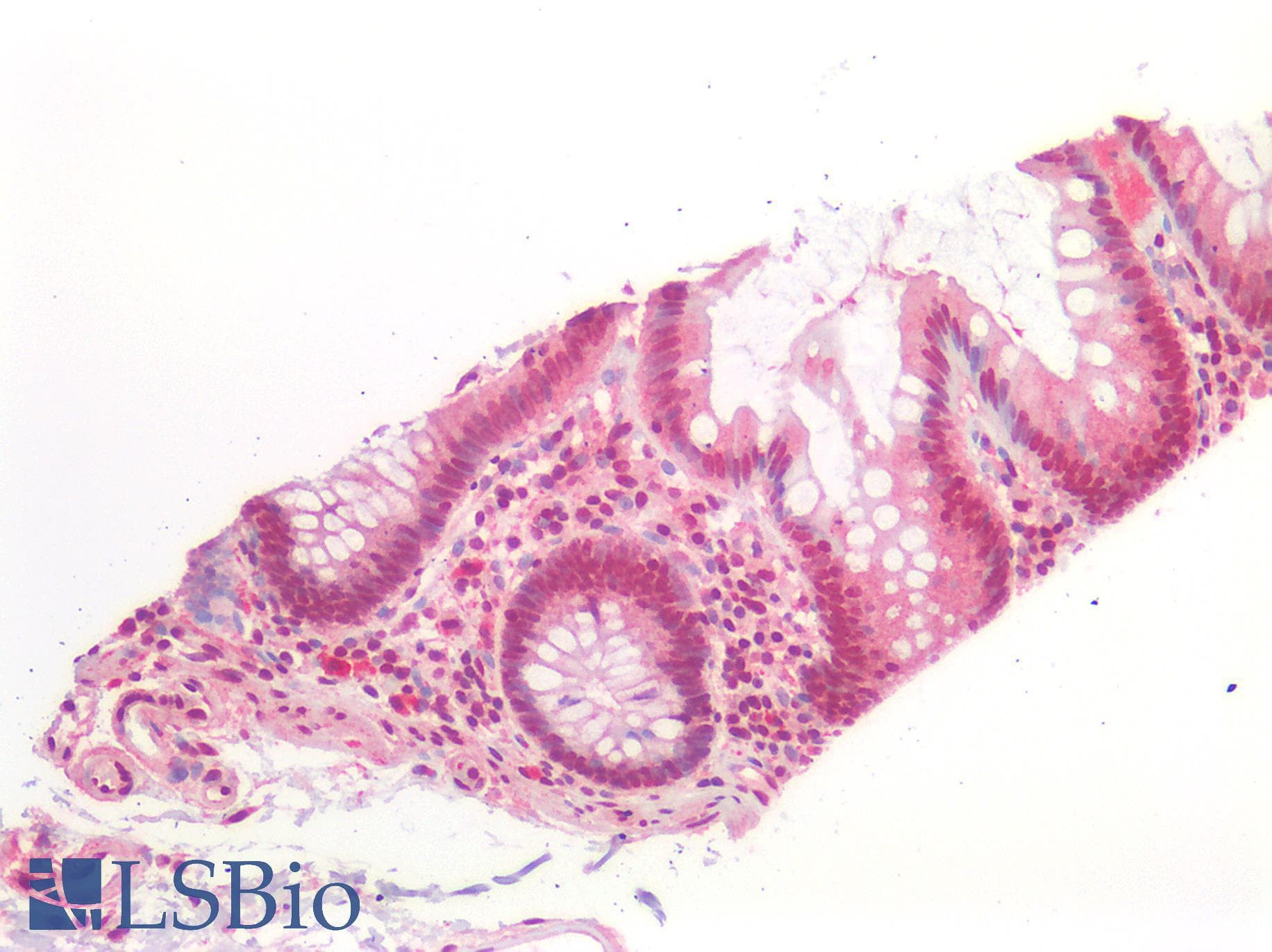 IHC-plus™ Polyclonal Rabbit anti-Human TP53 / p53 Antibody (IHC)