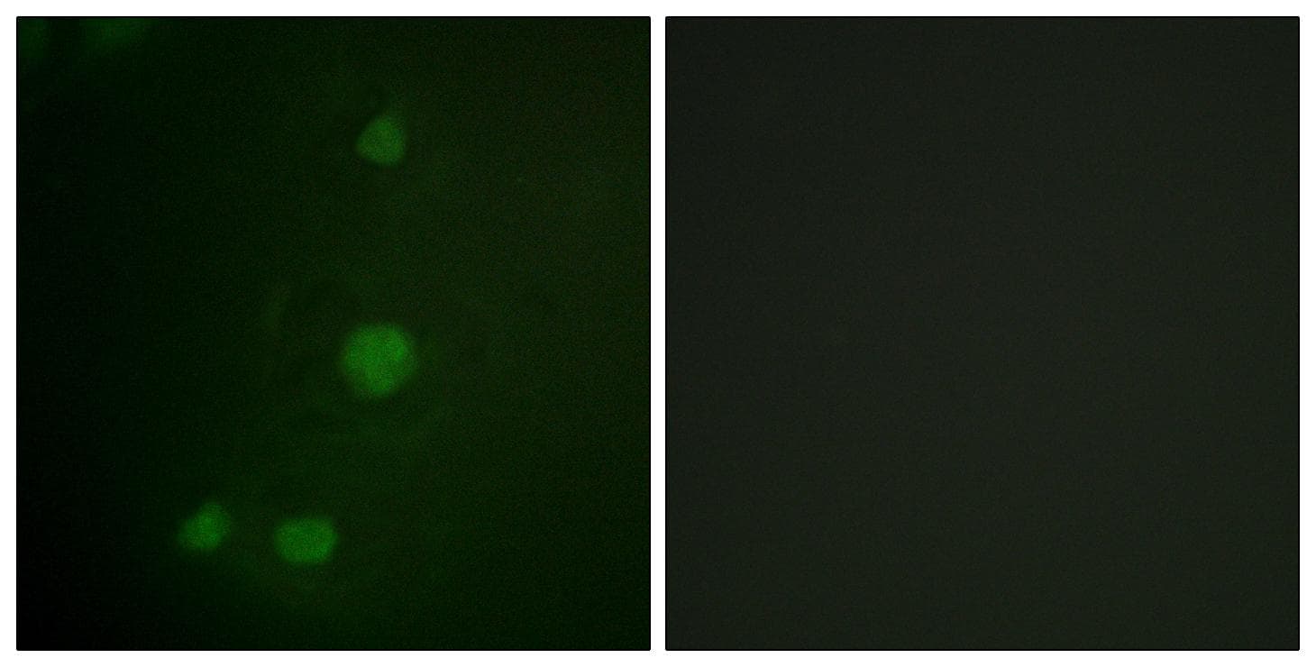 Polyclonal Rabbit anti-Human RB1 / Retinoblastoma / RB Antibody (p811, IF, WB)