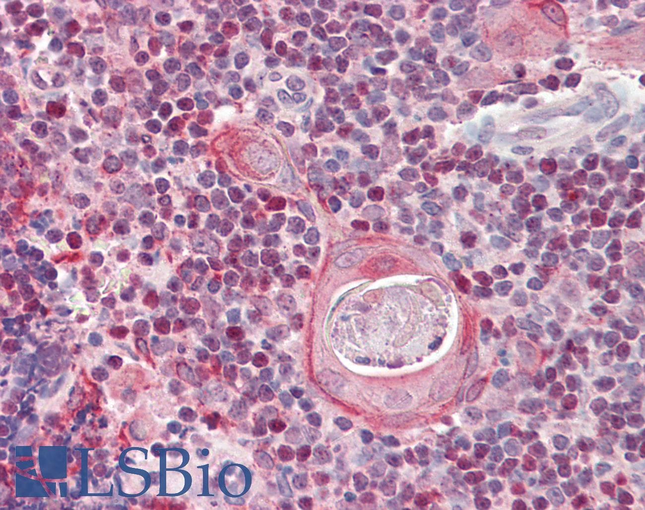 IHC-plus™ Polyclonal Goat anti-Human SATB1 Antibody (aa668-681, IHC, WB)