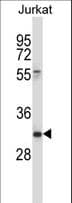 Polyclonal Rabbit anti-Human CD7 Antibody (aa63-92, WB)