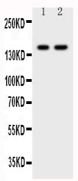 CD45 / LCA Antibody (aa1209-1227)