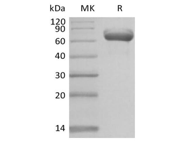 Human BTN1A1 Protein (Recombinant Fc, C-terminus)