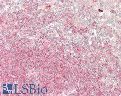 Polyclonal Rabbit anti-Human FAM175B / KIAA0157 Antibody (aa288-337, IHC, WB)