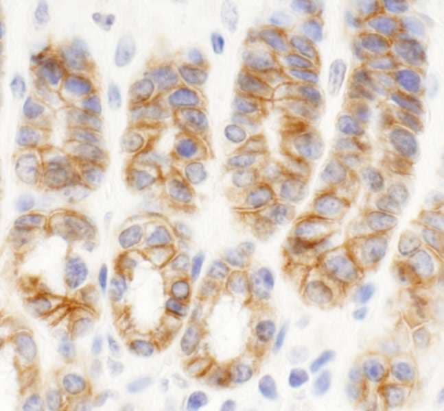 KIAA0528 Antibody (aa375-425)