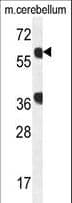 GTPBP2 Antibody (aa536-564)