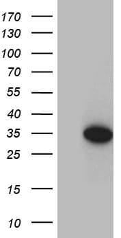 Monoclonal Mouse anti-Human CINP Antibody (clone OTI5A11, WB)