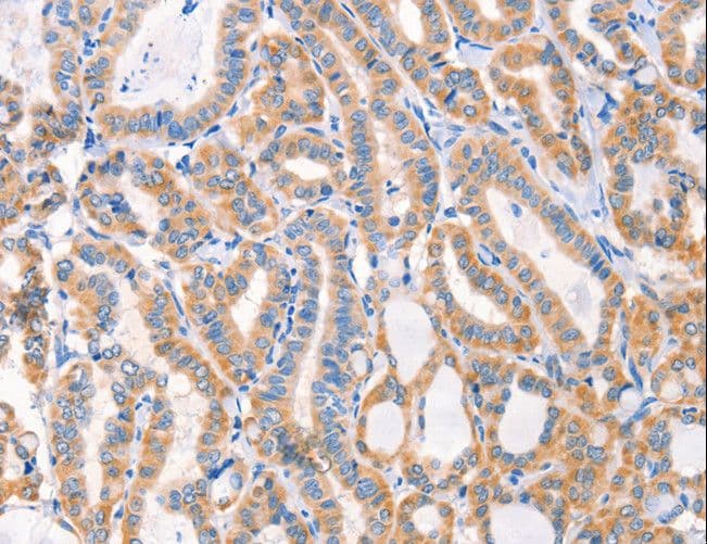 F13A1 / Factor XIIIa Antibody