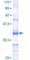 Human UBP43 / USP18 Protein (Recombinant GST, N-terminus)