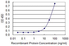 Monoclonal Mouse anti-Human ZIC3 Antibody (clone 4F7, WB)