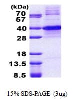 Human KLF7 Protein (Recombinant His)