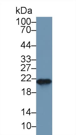 FTH1 / Ferritin Heavy Chain Antibody (aa1-182, APC)