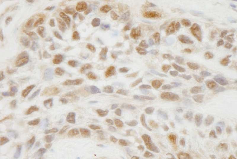 Polyclonal Rabbit anti-Human JMJD1C Antibody (aa150-200, IHC)
