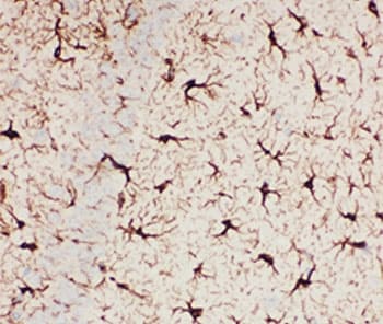 Polyclonal Rabbit anti-Human GFAP Antibody (IHC, WB)