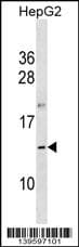 OOSP1 Antibody (aa 82-108, C-term)