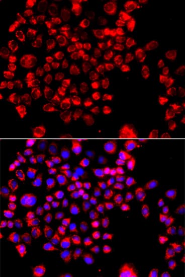 CCL11 / Eotaxin Antibody