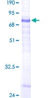 Human SGMS1 / TMEM23 Protein (Recombinant GST)