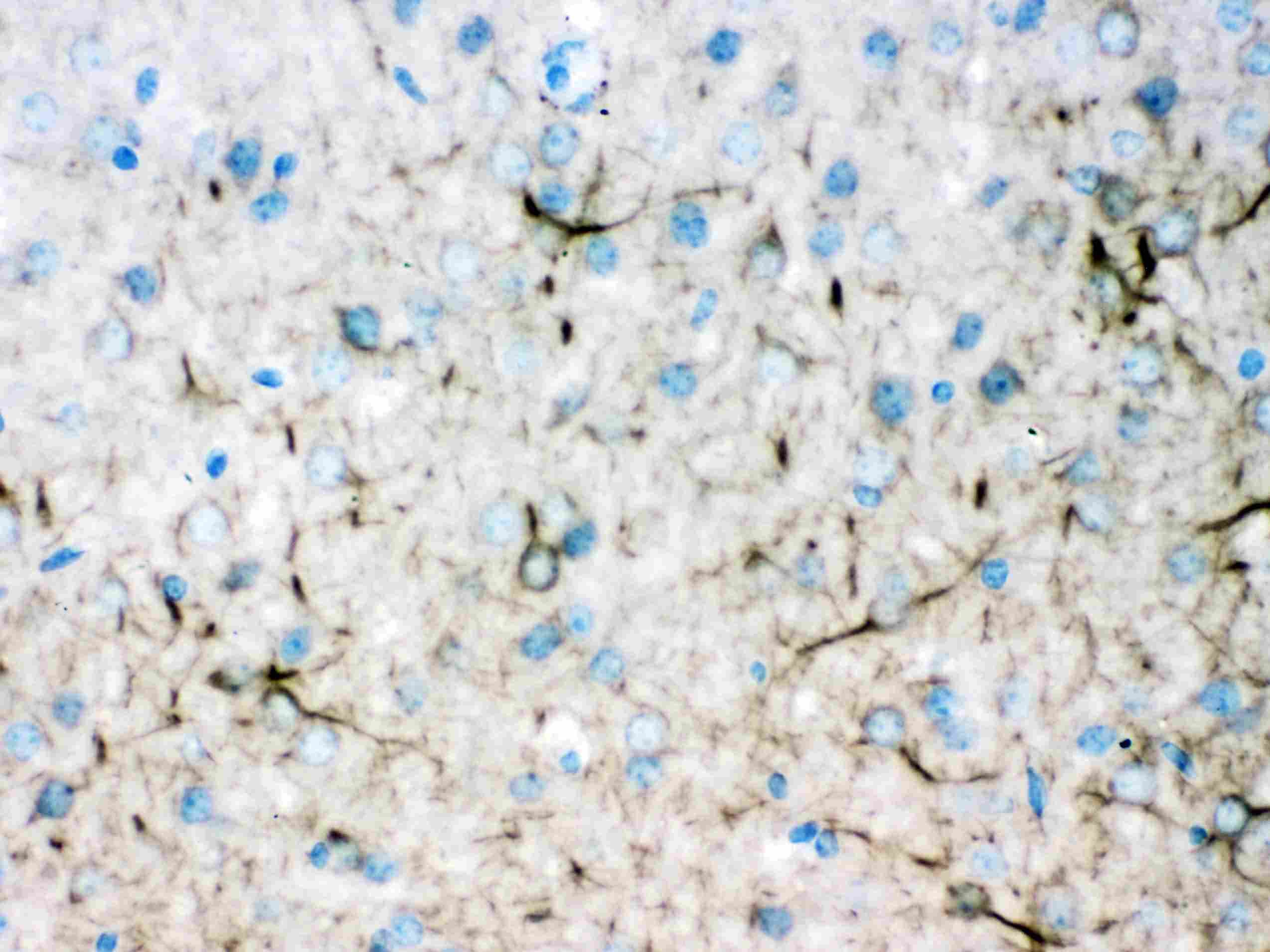Polyclonal Rabbit anti-Human INA / Alpha Internexin Antibody (IHC, WB)