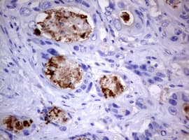 PIK3C2A Antibody (aa230-560, clone OTI3H2)