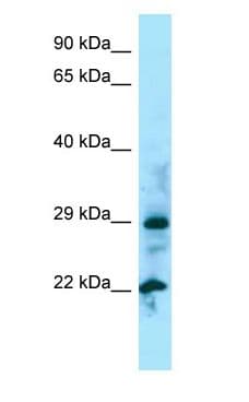 Polyclonal Rabbit anti-Human NUDT5 Antibody (aa32-81, WB)