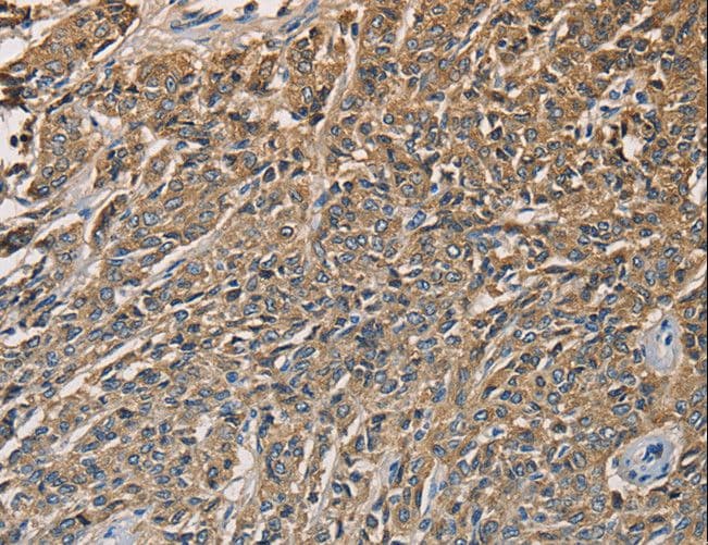 KLK1 / Kallikrein 1 Antibody