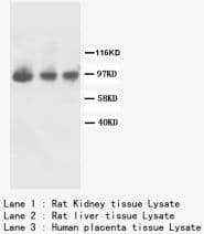 FGFR2 / FGF Receptor 2 Antibody (C-Terminus)