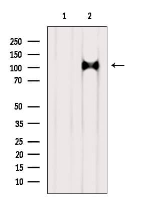 AP3D1 / Adaptin Delta Antibody