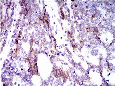 KRT5 / CK5 / Cytokeratin 5 Antibody (Amino Acid: 316-590, clone 10C11E6)