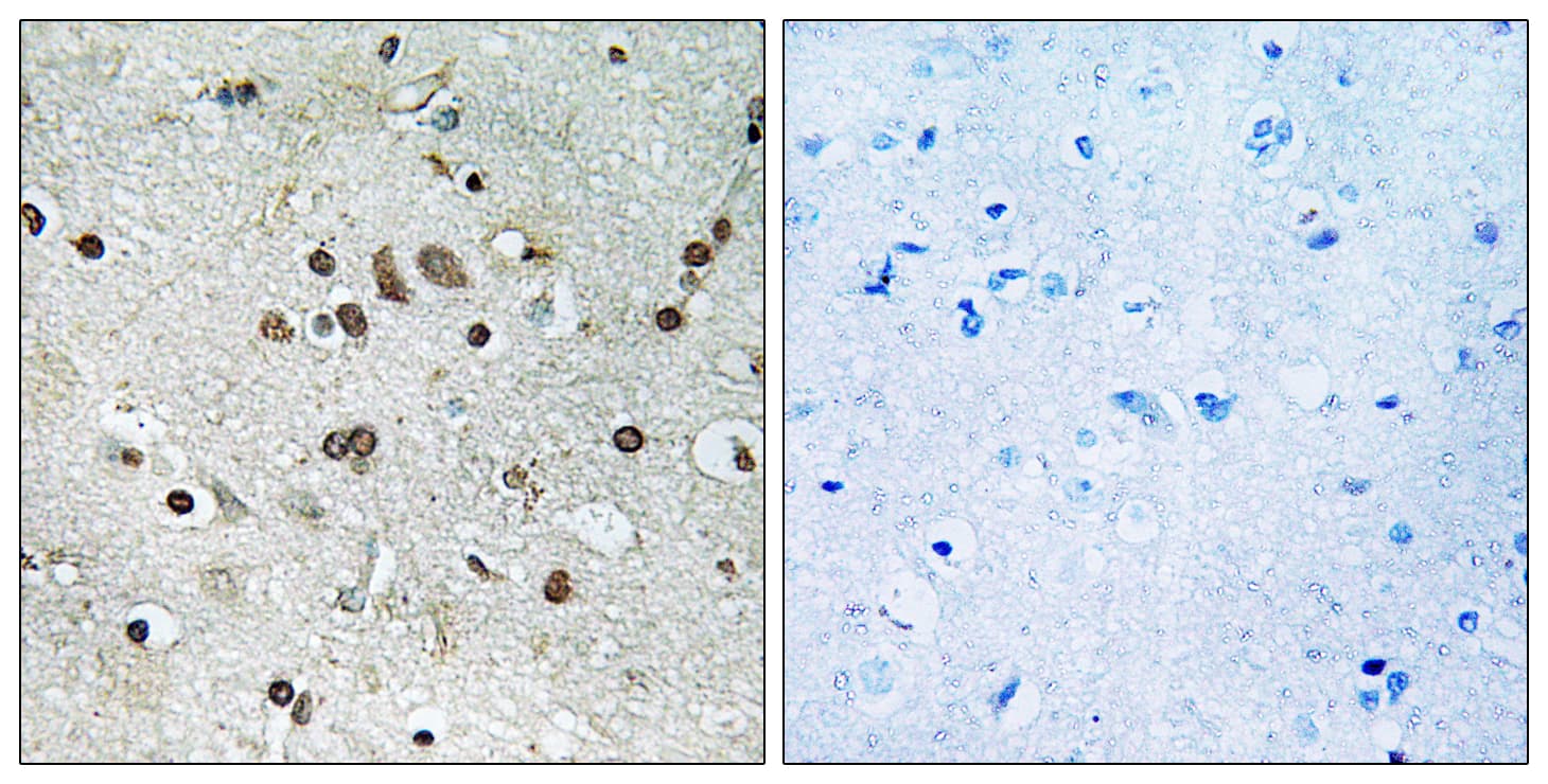 Polyclonal Rabbit anti-Human BTF3L4 Antibody (aa94-143, IHC)