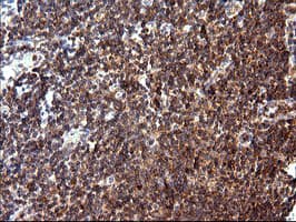Monoclonal Mouse anti-Human MLANA / Melan-A Antibody (clone OTI2G2, IHC, IF, WB)