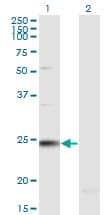 RAB7B Antibody (clone 1C3)