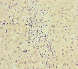 MCCC1 Antibody