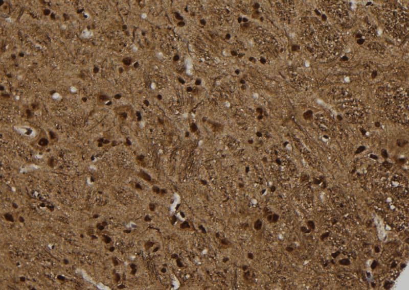 ARRB2 / Beta Arrestin 2 Antibody