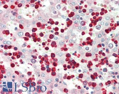 IHC-plus™ ZEB2 / SIP-1 Antibody (aa52-101)