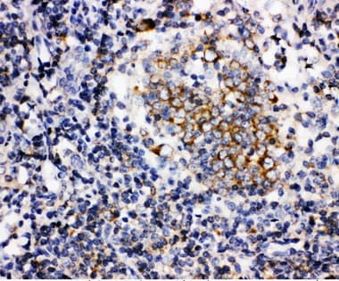 BAFF / TNFSF13B Antibody (aa265-285)