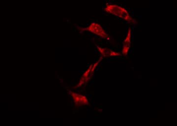 RPS6KB1 / P70S6K / S6K Antibody
