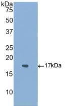 ALK2 / ACVR1 Antibody (aa208-340)