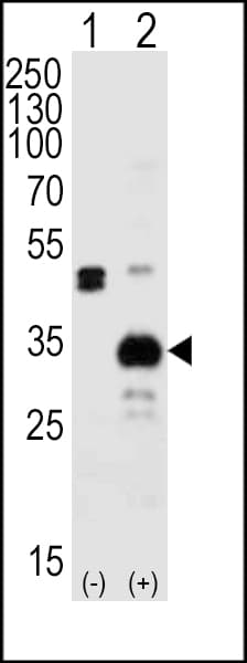 IHC-plus™ Polyclonal Rabbit anti-Human APG5 / ATG5 Antibody (aa1-30, IHC, IF, WB)
